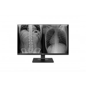 LG 27HJ713C-B 27" 16:9 8MP IPS Clinical Review Monitor